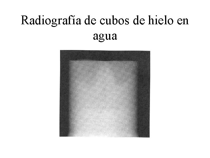 Radiografía de cubos de hielo en agua 