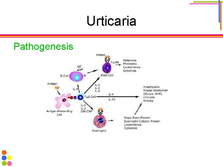 Urticaria Pathogenesis 