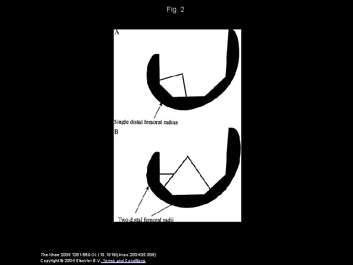 Fig. 2 The Knee 2005 1281 -88 DOI: (10. 1016/j. knee. 2004. 05. 006)