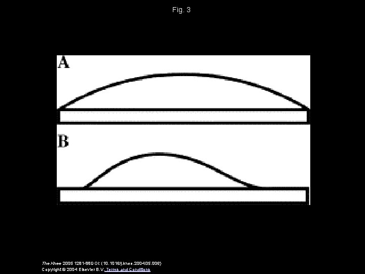 Fig. 3 The Knee 2005 1281 -88 DOI: (10. 1016/j. knee. 2004. 05. 006)