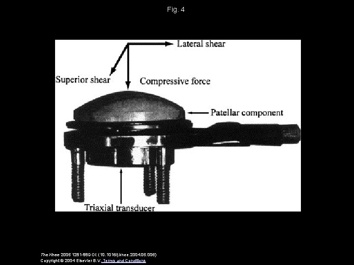 Fig. 4 The Knee 2005 1281 -88 DOI: (10. 1016/j. knee. 2004. 05. 006)