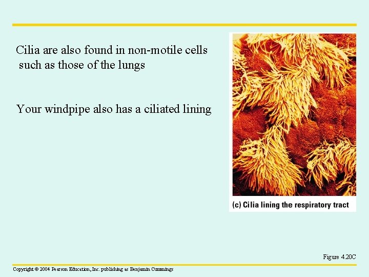 Cilia are also found in non-motile cells such as those of the lungs Your