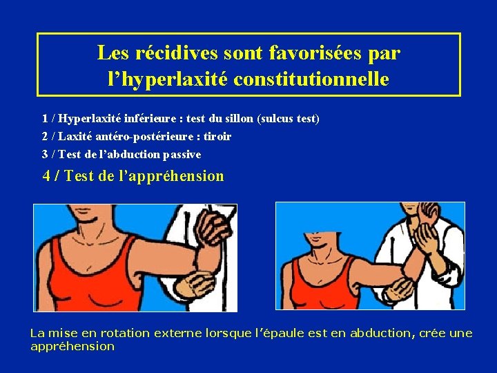 Les récidives sont favorisées par l’hyperlaxité constitutionnelle 1 / Hyperlaxité inférieure : test du