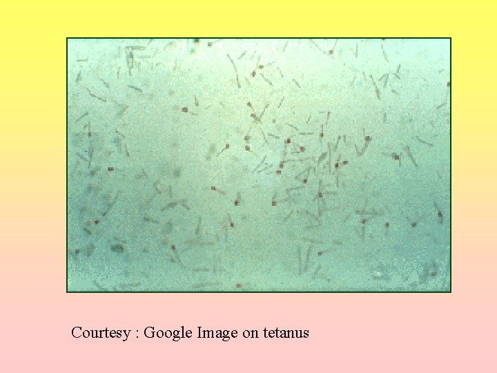 Courtesy : Google Image on tetanus 