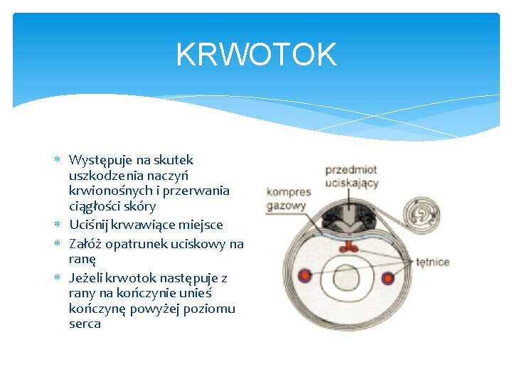 KRWOTOK Występuje na skutek uszkodzenia naczyń krwionośnych i przerwania ciągłości skóry Uciśnij krwawiące miejsce