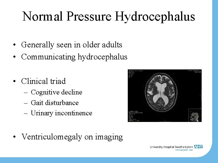 Normal Pressure Hydrocephalus • Generally seen in older adults • Communicating hydrocephalus • Clinical