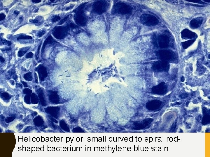 Helicobacter pylori small curved to spiral rodshaped bacterium in methylene blue stain 