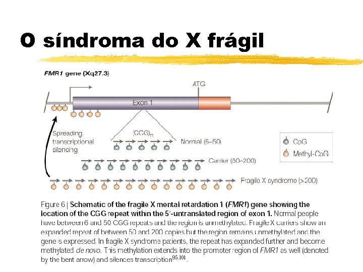 O síndroma do X frágil 