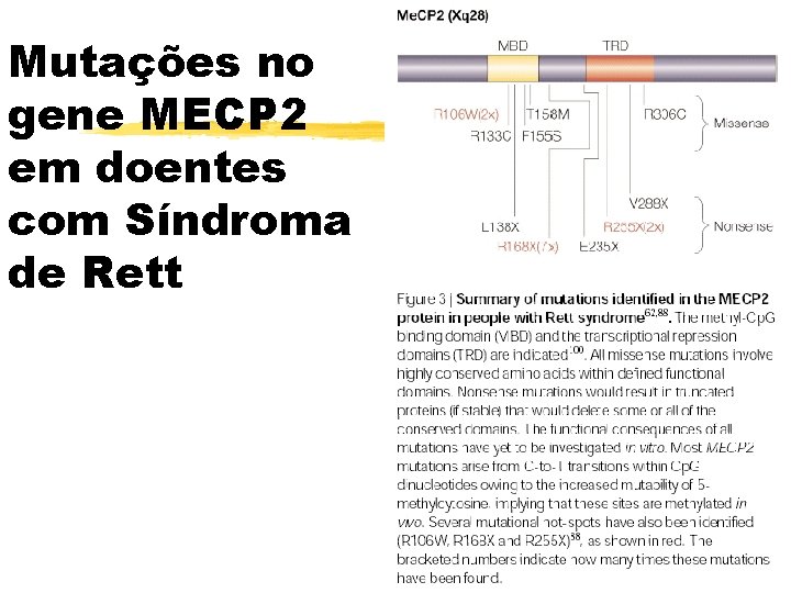 Mutações no gene MECP 2 em doentes com Síndroma de Rett 