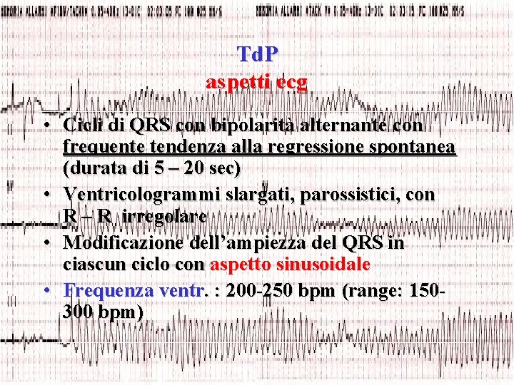 Td. P aspetti ecg • Cicli di QRS con bipolarità alternante con frequente tendenza