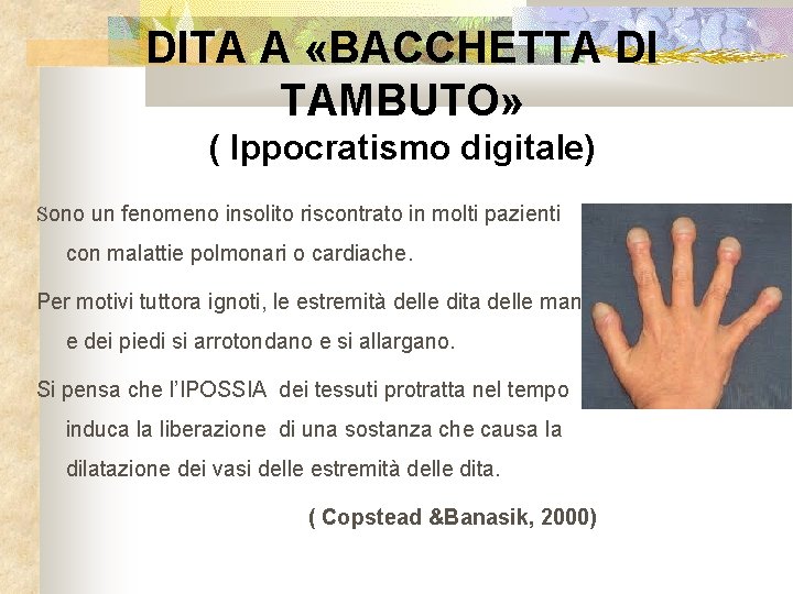 DITA A «BACCHETTA DI TAMBUTO» ( Ippocratismo digitale) Sono un fenomeno insolito riscontrato in