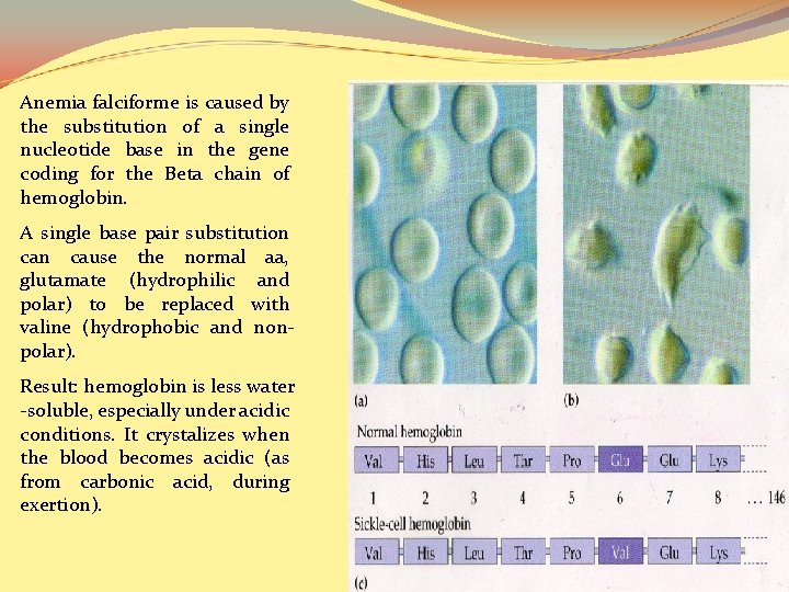 Anemia falciforme is caused by the substitution of a single nucleotide base in the