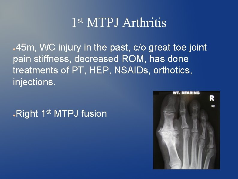 1 st MTPJ Arthritis 45 m, WC injury in the past, c/o great toe