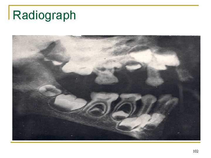 Radiograph 102 