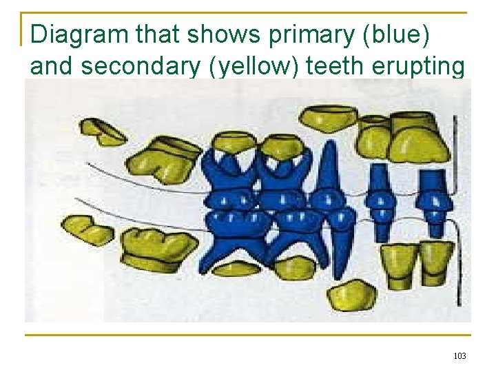 Diagram that shows primary (blue) and secondary (yellow) teeth erupting 103 