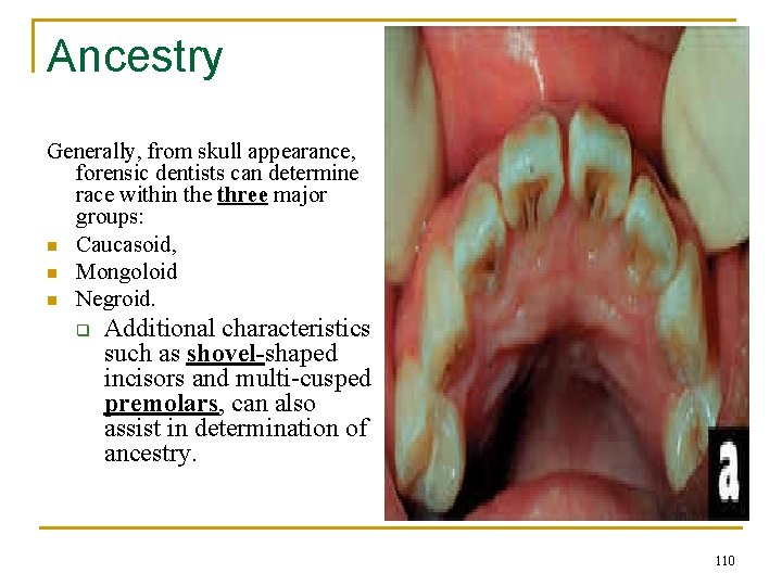 Ancestry Generally, from skull appearance, forensic dentists can determine race within the three major