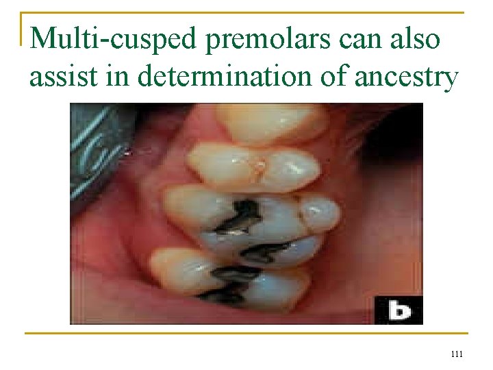 Multi-cusped premolars can also assist in determination of ancestry 111 