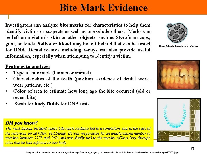 Bite Mark Evidence Investigators can analyze bite marks for characteristics to help them identify