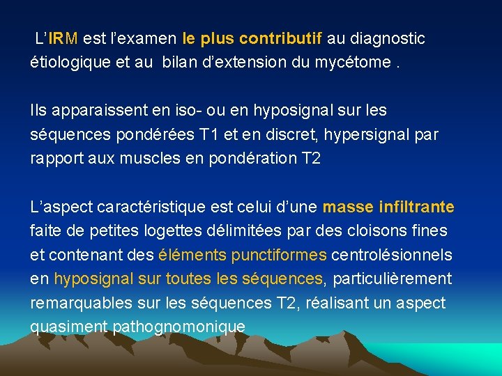 L’IRM est l’examen le plus contributif au diagnostic étiologique et au bilan d’extension du