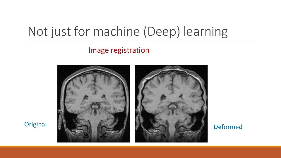 Not just for machine (Deep) learning Image registration Original Deformed 