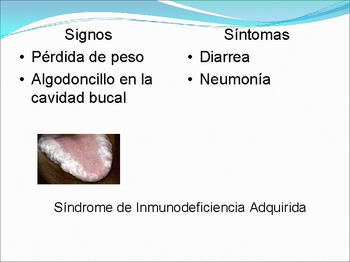 Signos • Pérdida de peso • Algodoncillo en la cavidad bucal Síntomas • Diarrea
