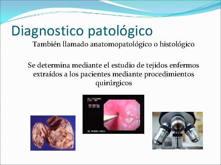 Diagnostico patológico También llamado anatomopatológico o histológico Se determina mediante el estudio de tejidos
