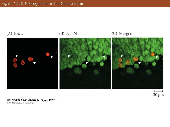 Figure 17. 28 Neurogenesis in the Dentate Gyrus Figure 17. 28 Neurogenesis in the Dentate Gyrus