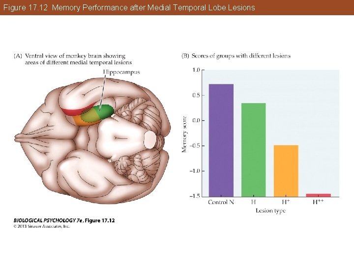 Figure 17. 12 Memory Performance after Medial Temporal Lobe Lesions Figure 17. 12 Memory Performance after Medial Temporal Lobe Lesions