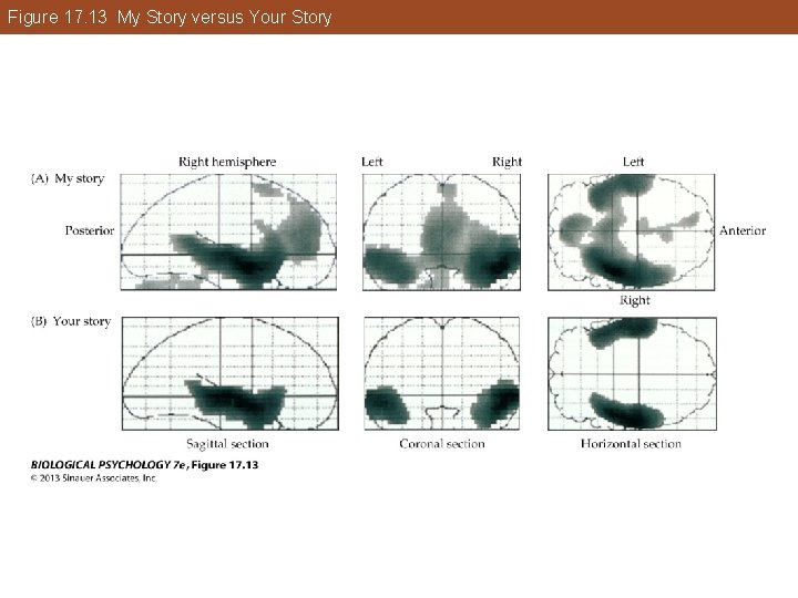 Figure 17. 13 My Story versus Your Story Figure 17. 13 My Story versus Your Story