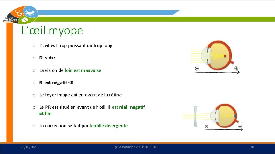 L’œil myope o L’œil est trop puissant ou trop long o Di < dsr