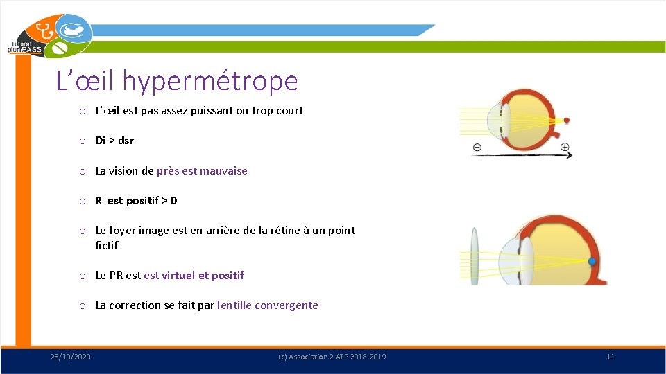 L’œil hypermétrope o L’œil est pas assez puissant ou trop court o Di >