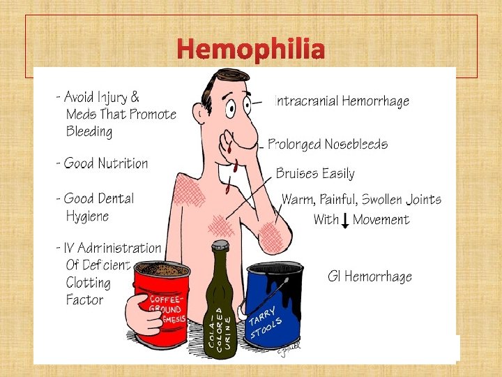 Hemophilia 