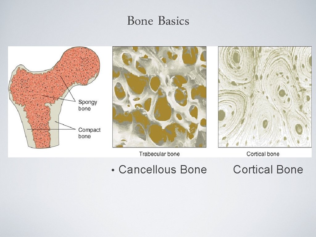 Bone Basics • Cancellous Bone Cortical Bone 