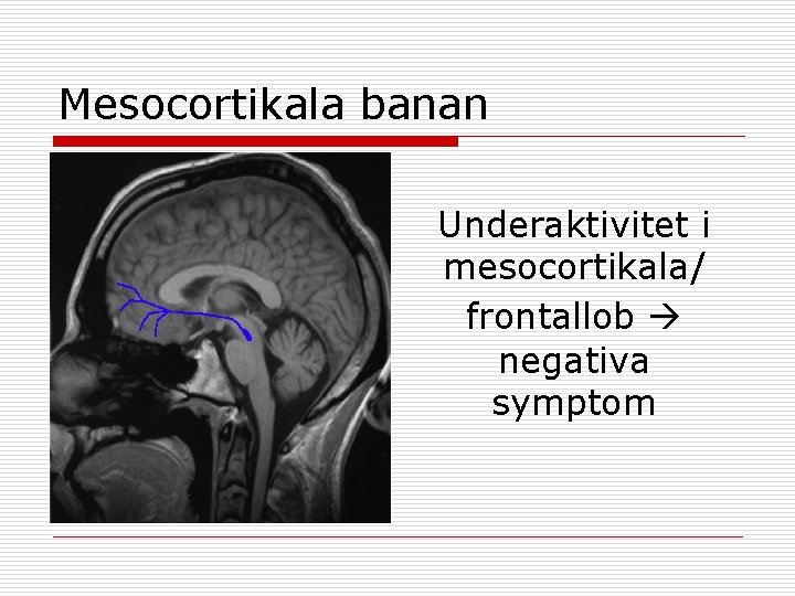 Mesocortikala banan Underaktivitet i mesocortikala/ frontallob negativa symptom 