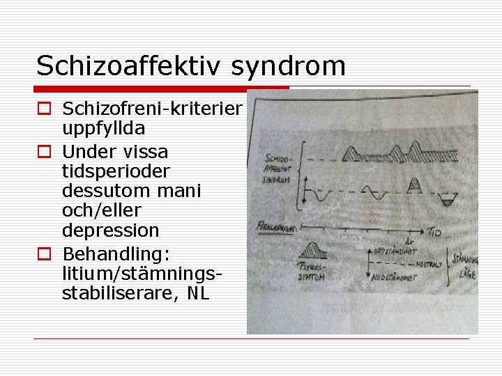 Schizoaffektiv syndrom o Schizofreni-kriterier uppfyllda o Under vissa tidsperioder dessutom mani och/eller depression o