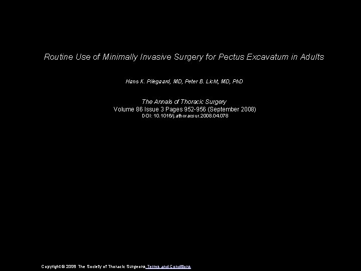 Routine Use of Minimally Invasive Surgery for Pectus Excavatum in Adults Hans K. Pilegaard,