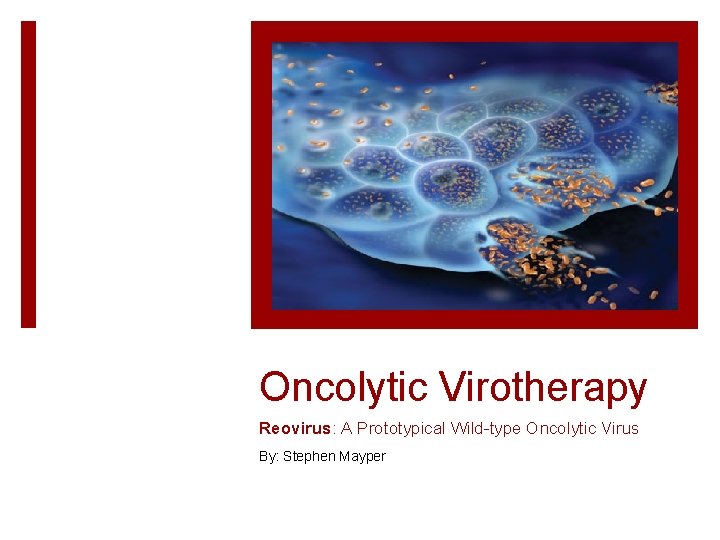 Oncolytic Virotherapy Reovirus: A Prototypical Wild-type Oncolytic Virus By: Stephen Mayper 