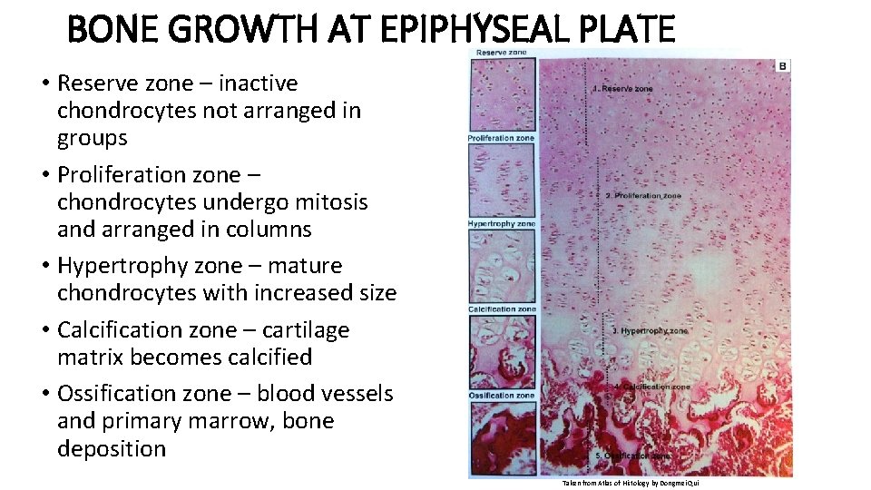 BONE GROWTH AT EPIPHYSEAL PLATE • Reserve zone – inactive chondrocytes not arranged in