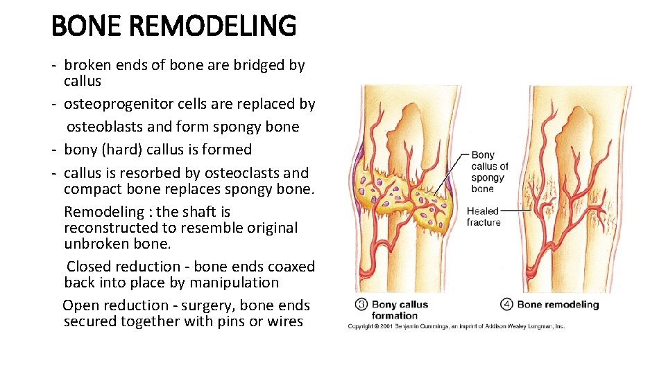 BONE REMODELING - broken ends of bone are bridged by callus - osteoprogenitor cells