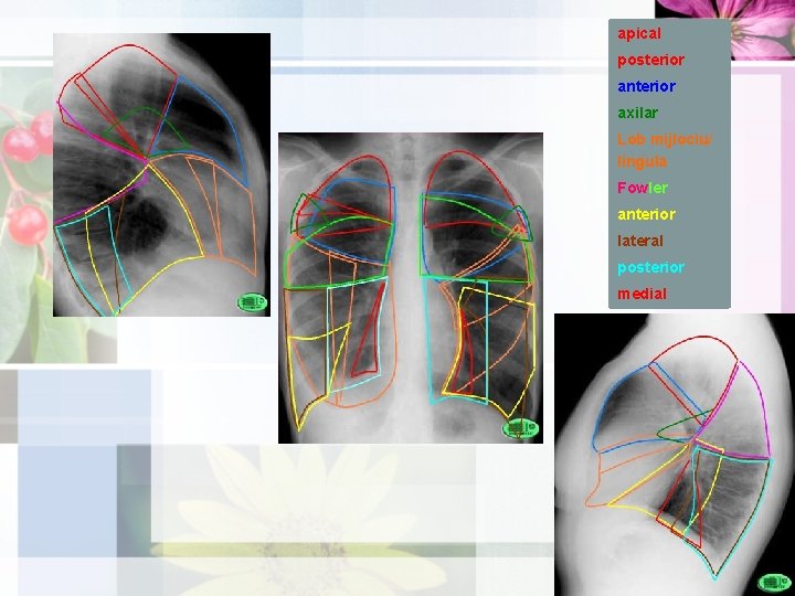 apical posterior anterior axilar Lob mijlociu/ lingula Fowler anterior lateral posterior medial 