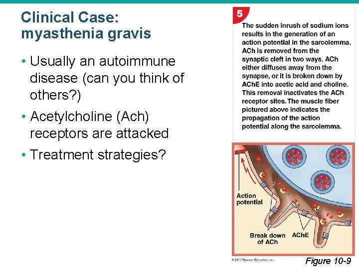 Clinical Case: myasthenia gravis • Usually an autoimmune disease (can you think of others?