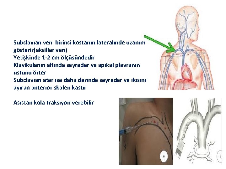 Subclavıan ven birinci kostanın lateralınde uzanım gösterir(aksiller ven) Yetişkinde 1 -2 cm ölçüsündedir Klavikulanın