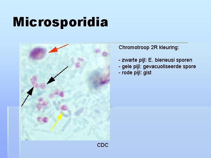 Microsporidia Chromotroop 2 R kleuring: - zwarte pijl: E. bieneusi sporen - gele pijl:
