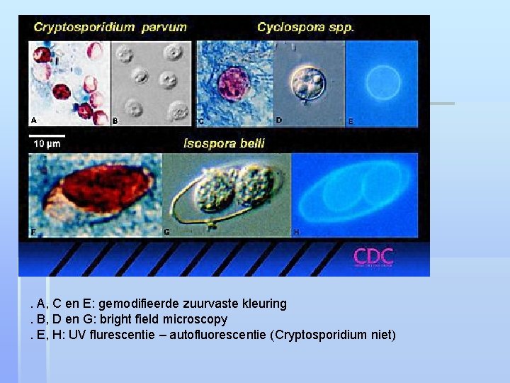 . A, C en E: gemodifieerde zuurvaste kleuring. B, D en G: bright field