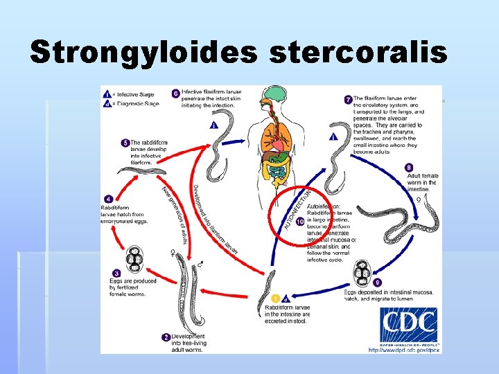 Strongyloides stercoralis 