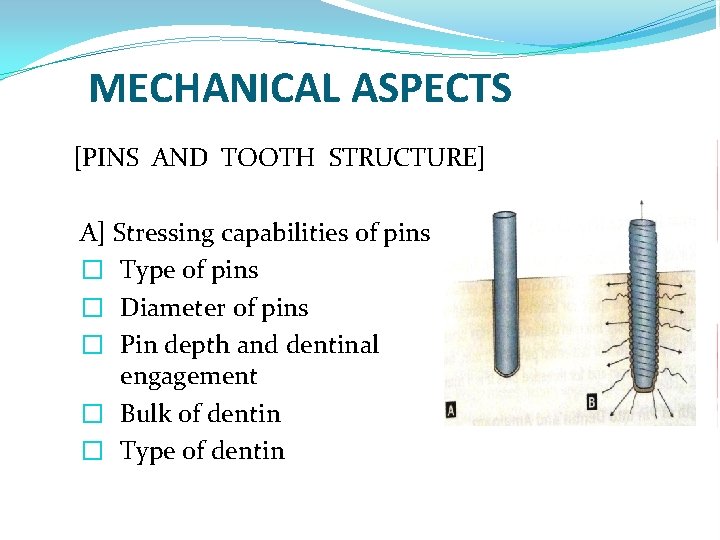 MECHANICAL ASPECTS [PINS AND TOOTH STRUCTURE] A] Stressing capabilities of pins � Type of