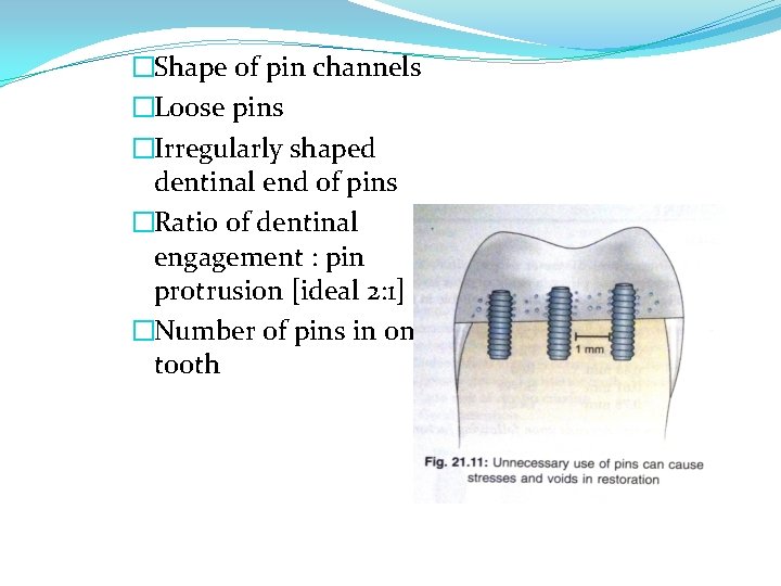 �Shape of pin channels �Loose pins �Irregularly shaped dentinal end of pins �Ratio of