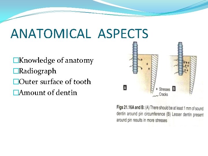 ANATOMICAL ASPECTS �Knowledge of anatomy �Radiograph �Outer surface of tooth �Amount of dentin 