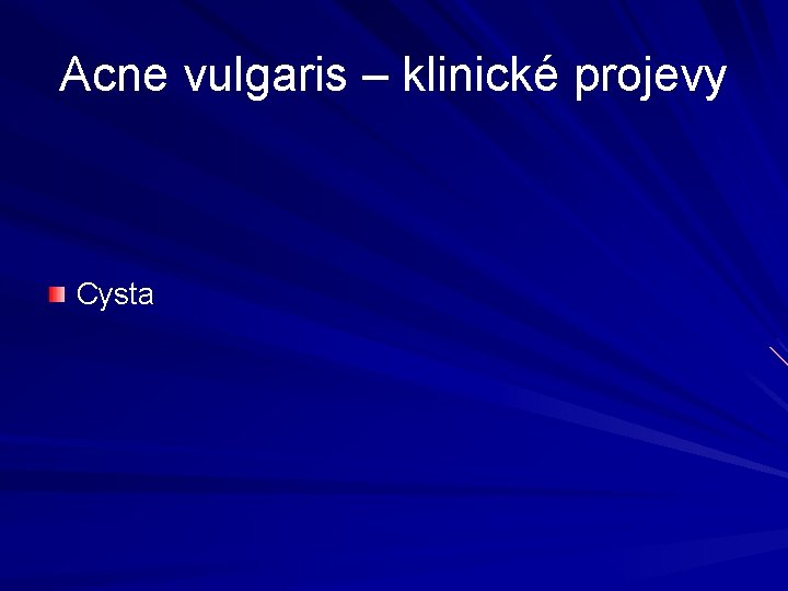 Acne vulgaris – klinické projevy Cysta Acne vulgaris – klinické projevy Cysta