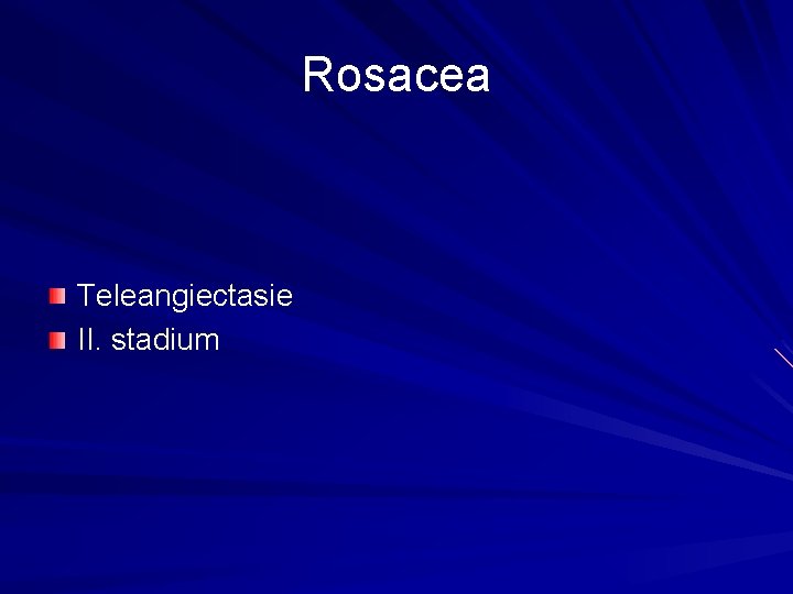 Rosacea Teleangiectasie II. stadium Rosacea Teleangiectasie II. stadium